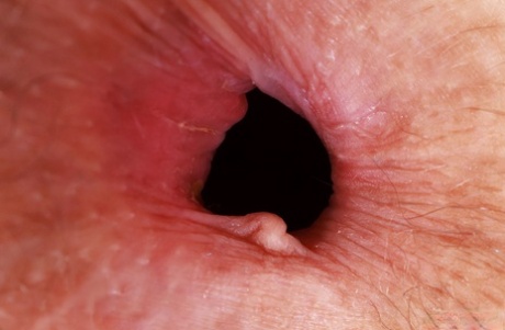asshole close up free xxx pictures