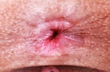 anus top photo