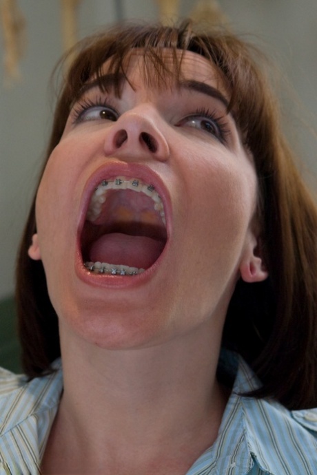 teen braces hot sexy images